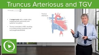 Surgical Management of Tricuspid Regurgitation in Pacemaker Leads [upl. by Lauzon]