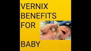 BENEFITS OF VERNIX TO YOUR NEW BORN BABY [upl. by Akinihs]