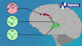 EEG for Anesthesiology  Part 3 Propofol [upl. by Akieluz]