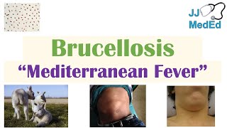 Brucellosis Mediterranean Fever  Transmission Pathogenesis Symptoms Diagnosis Treatment [upl. by Summer481]