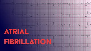 What is atrial flutter [upl. by Niwhsa]