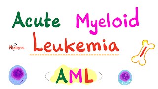 Acute Myeloid Leukemia AML  Auer Rods  Myeloperoxidase Positive  Hematology amp Oncology Series [upl. by Esdnil141]