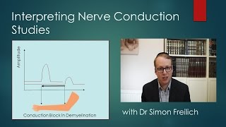 Interpreting Nerve Conduction Studies [upl. by Schuh]