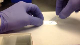 Hematology Making a Peripheral Blood Smear [upl. by Aihsi]