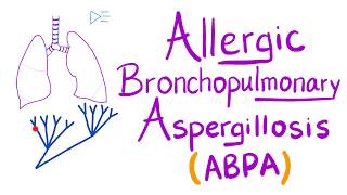 Allergic Bronchopulmonary Aspergillosis ABPA  Asthma Cough Eosinophils  Lungs [upl. by Ahsirkal]