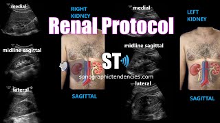 Renal Ultrasound Protocol [upl. by Franchot]