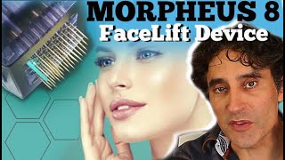 MORPHEUS 8  Non Surgical Facelift [upl. by Mahmud150]