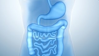 What Are Colon Polyps [upl. by Anirol]