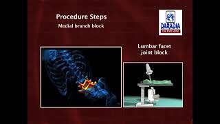 Fluoroscopy guided Facet Joint interventions [upl. by Eelyah]