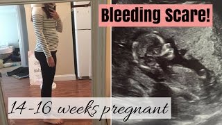 1416 weeks pregnant BLEEDING SCARE SCH [upl. by Grimbal]