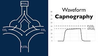 Waveform Capnography  BAVLS [upl. by Edmanda]