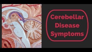 Cerebellar Disease Symptoms [upl. by Diley]