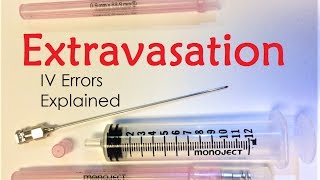 Extravasation  IV Infiltration Errors Explained Doctor Interview [upl. by Fons]