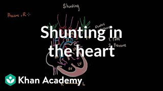 Shunting in the heart  Circulatory System and Disease  NCLEXRN  Khan Academy [upl. by Norrad13]