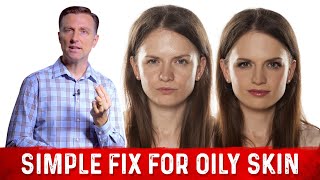 How To Fix Oily Skin With Simple Hack – Dr Berg [upl. by Natye]