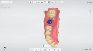 3Shape TRIOS Implant restoration workflow IT [upl. by Alabaster844]