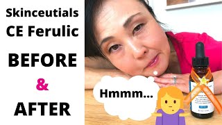 SkinceuticalsCE Ferulic Worth it Before and After [upl. by Lusa]