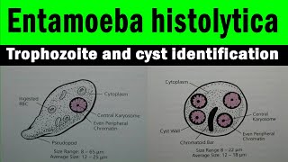 Entamoeba histolytica trophozoite and cyst  microscopic view with identification features [upl. by Anevad]