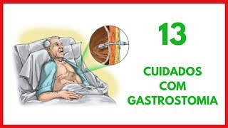 Cuidados de Enfermagem com Gastrostomia [upl. by Nauh]