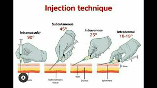 Injection Techniques quotIntermuscular Subcutaneous Intravenous Intradermalquot [upl. by Dlanar]