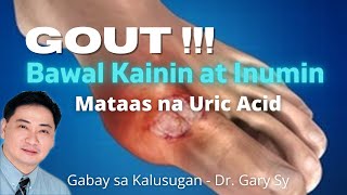 GOUT Bawal Kainin at Inumin  Dr Gary Sy [upl. by Manno675]