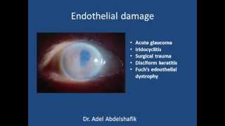 Cornea  1 anatomy [upl. by Isewk]