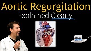 Echo Evaluation in Aortic Regurgitation [upl. by Ardnalac]