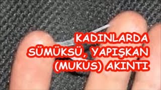 KADINLARDA SÜMÜKSÜ YAPIŞKAN MUKUS AKINTI [upl. by Taryn]