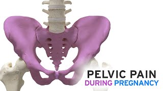 Pelvic Pain During Pregnancy [upl. by Aniratak]