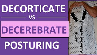 Decerebrate vs Decorticate Posturing Rigidity Mnemonic amp Pictures Nursing NCLEX [upl. by Kenimod597]