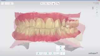 3Shape TRIOS  Analyze Page Tools [upl. by Kai]