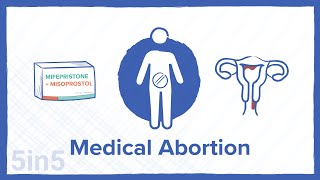 Medical Abortion [upl. by Ylenaj]