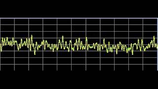 Metabolism Repair  Rife Frequencies [upl. by Casavant961]