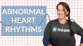 EKG like a BOSS Part 3  Abnormal Heart Rhythms [upl. by Aleil]