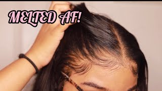 How to RE Install Frontal Wigs for Beginners  VERY DETAILED  Melt Transparent Lace [upl. by Caruso]