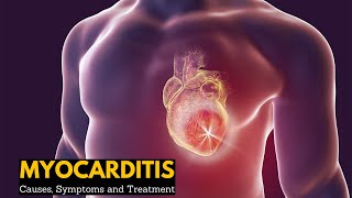 Myocarditis Causes Signs and Symptoms Diagnosis Treatment [upl. by Ardnasella]