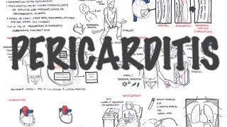 Pericarditis  Overview signs and symptoms pathophysiology diagnosis treatment [upl. by Ruskin]