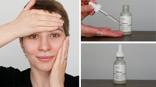 How to use The Ordinary Niacinamide 10  Zinc 1  Full Demonstration [upl. by Yetta]