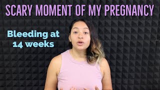 Bleeding during pregnancy  Bleeding in the second trimester  14 weeks pregnant  Part 1 [upl. by Fitz]