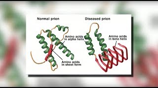 What Is Chronic Granulomatous Disease [upl. by Childers]