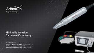 Minimally Invasive Calcaneal Osteotomy [upl. by Notgnirrab]