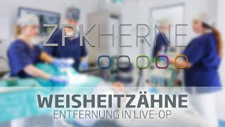 Wie werden Weissheitszähne entfernt Live ZahnOP [upl. by Aremahs292]