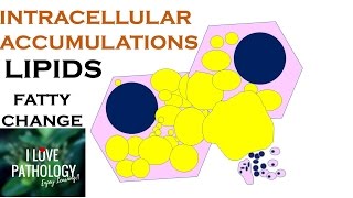 INTRACELLULAR ACCUMULATIONS LIPIDS Fatty Change [upl. by Crispa609]