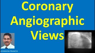 Coronary Angiographic Views [upl. by Portuna]