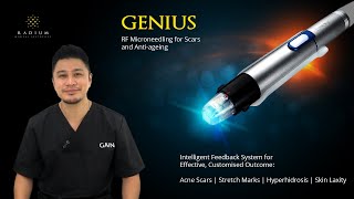 Genius RF MicroNeedling In 1 Minute  Radium Medical Aesthetics [upl. by Nohtanoj]