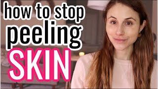 How to STOP PEELING SKIN Dr Dray [upl. by Nairrad]