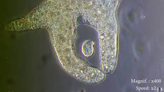 Amoeba eats paramecia  Amoebas lunch   Amoeba Endocytosis  Phagocytosis Part 1  👌 [upl. by Putnam]