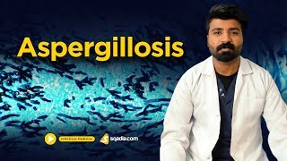 Aspergillosis  Infectious Clinical Medicine  Online Video Lectures  VLearning [upl. by Netsud]