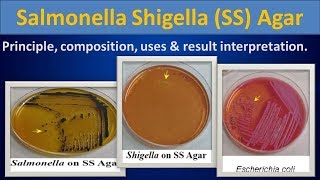 Salmonella shigella SS Agar [upl. by Aciraa651]