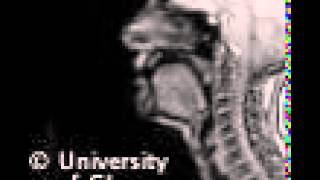 Voiceless uvular fricative MRI [upl. by Llejk]